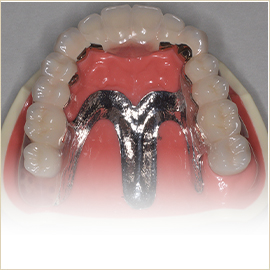 義歯・入れ歯
